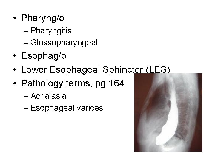  • Pharyng/o – Pharyngitis – Glossopharyngeal • Esophag/o • Lower Esophageal Sphincter (LES)
