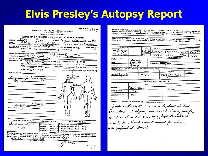 Elvis Presley’s Autopsy Report 