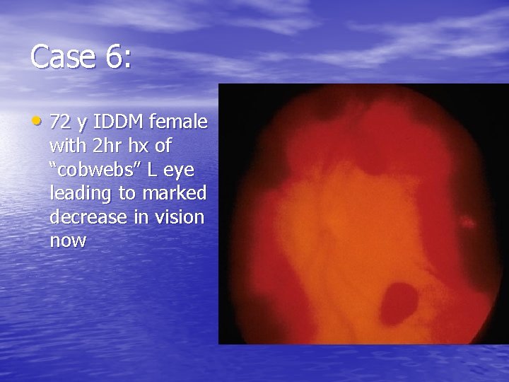 Case 6: • 72 y IDDM female with 2 hr hx of “cobwebs” L