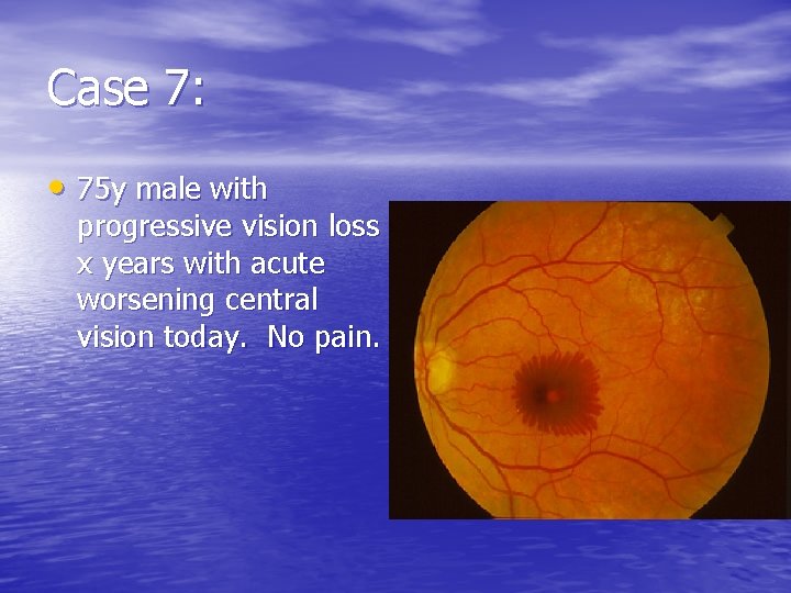 Case 7: • 75 y male with progressive vision loss x years with acute