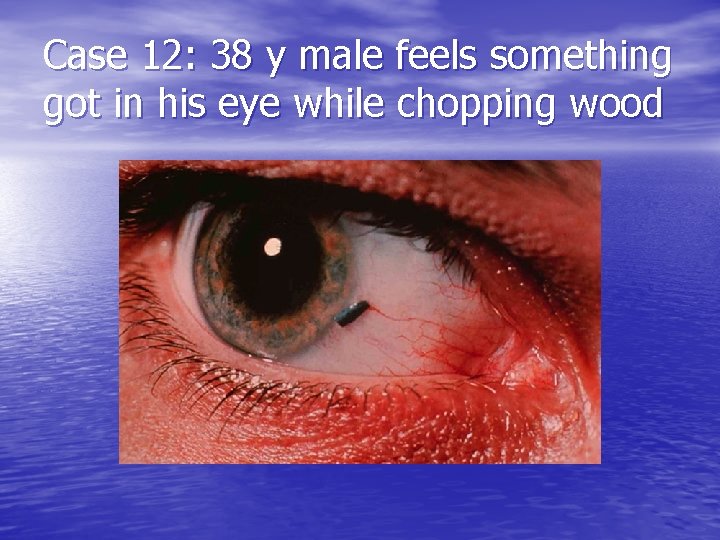 Case 12: 38 y male feels something got in his eye while chopping wood
