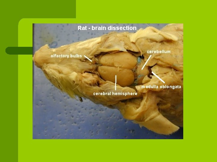 medulla oblongata 