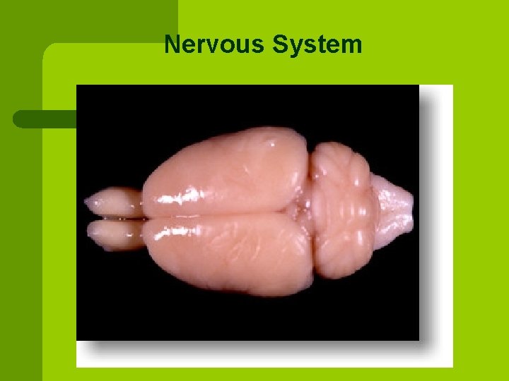 Nervous System 