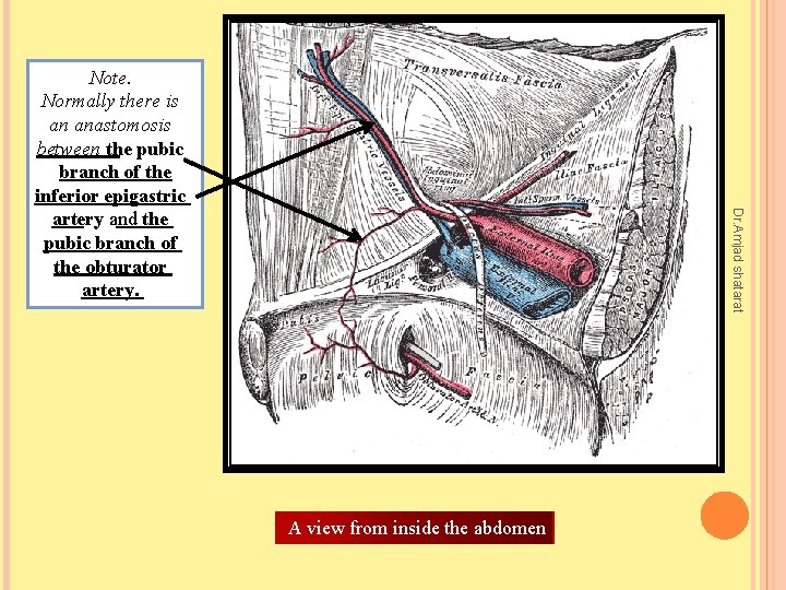 Dr. Amjad shatarat Note. Normally there is an anastomosis between the pubic branch of