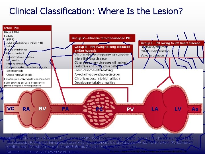 Clinical Classification: Where Is the Lesion? VC RA RV PA PC PV LA LV