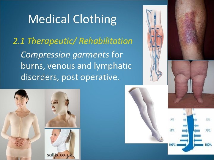 Medical Clothing 2. 1 Therapeutic/ Rehabilitation Compression garments for burns, venous and lymphatic disorders,