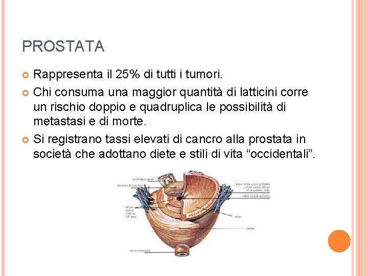 PROSTATA Rappresenta il 25% di tutti i tumori. Chi consuma una maggior quantità di