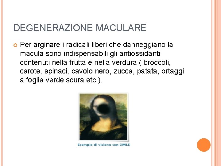 DEGENERAZIONE MACULARE Per arginare i radicali liberi che danneggiano la macula sono indispensabili gli