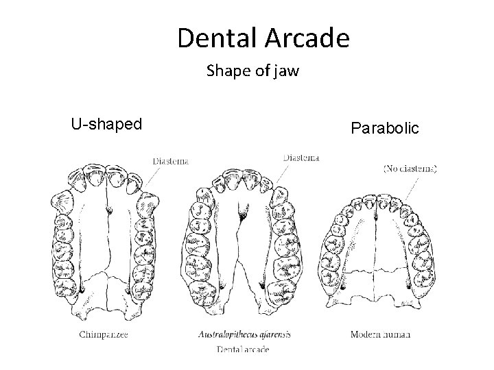 Dental Arcade Shape of jaw U-shaped Parabolic Figure 11. 10 a 