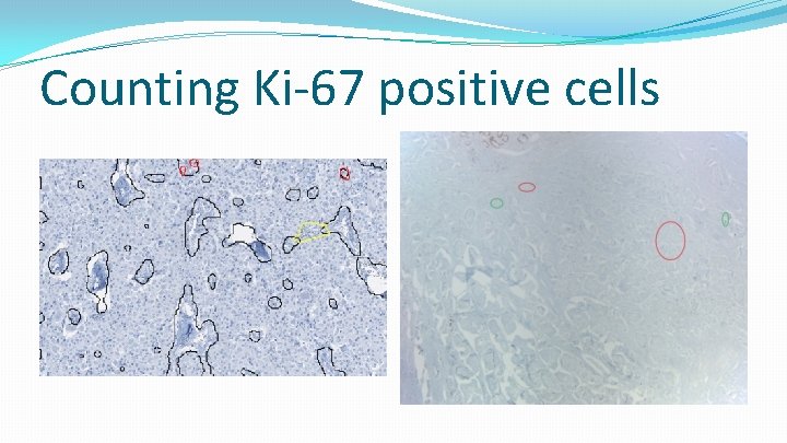 Counting Ki-67 positive cells 