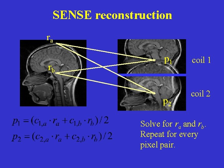 SENSE reconstruction ra rb p 1 p 2 coil 1 coil 2 Solve for