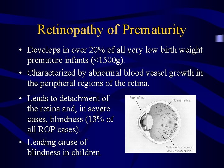 Retinopathy of Prematurity • Develops in over 20% of all very low birth weight