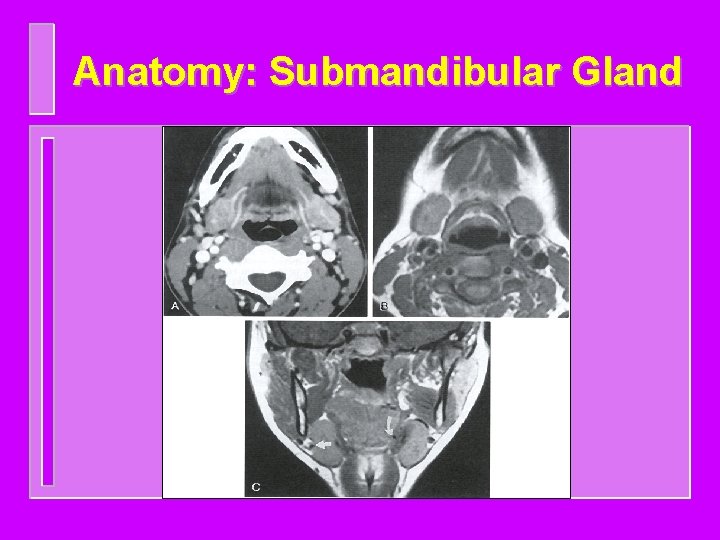 Anatomy: Submandibular Gland 