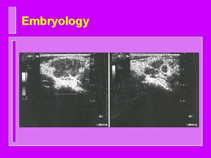 Embryology 