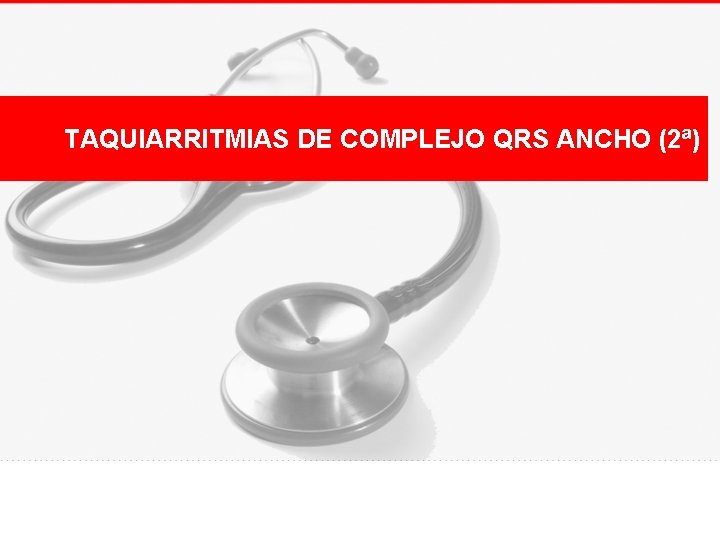 TAQUIARRITMIAS DE COMPLEJO QRS ANCHO (2ª) 