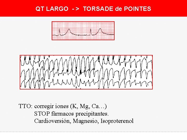 QT LARGO - > TORSADE de POINTES TTO: corregir iones (K, Mg, Ca…) STOP