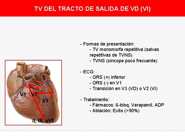 TV DEL TRACTO DE SALIDA DE VD (VI) - Formas de presentación: - TV