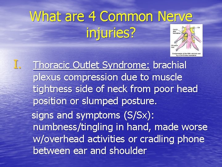 What are 4 Common Nerve injuries? I. Thoracic Outlet Syndrome: brachial plexus compression due What are 4 Common Nerve injuries? I. Thoracic Outlet Syndrome: brachial plexus compression due