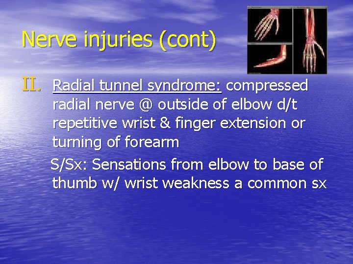 Nerve injuries (cont) II. Radial tunnel syndrome: compressed radial nerve @ outside of elbow Nerve injuries (cont) II. Radial tunnel syndrome: compressed radial nerve @ outside of elbow