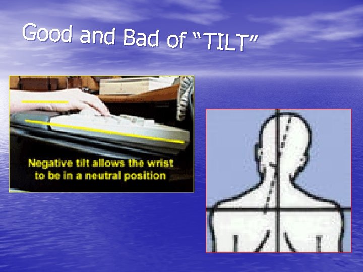 Good and Bad of “ TIL T” Good and Bad of “ TIL T”