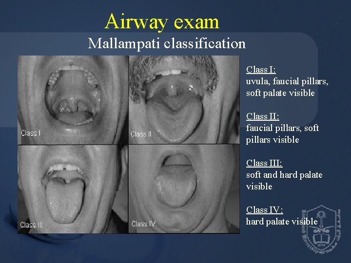 Airway exam Mallampati classification Class I: uvula, faucial pillars, soft palate visible Class II: