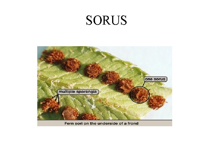 SORUS 