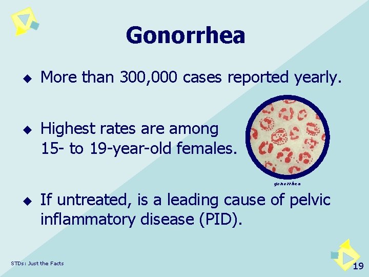 Gonorrhea u u More than 300, 000 cases reported yearly. Highest rates are among