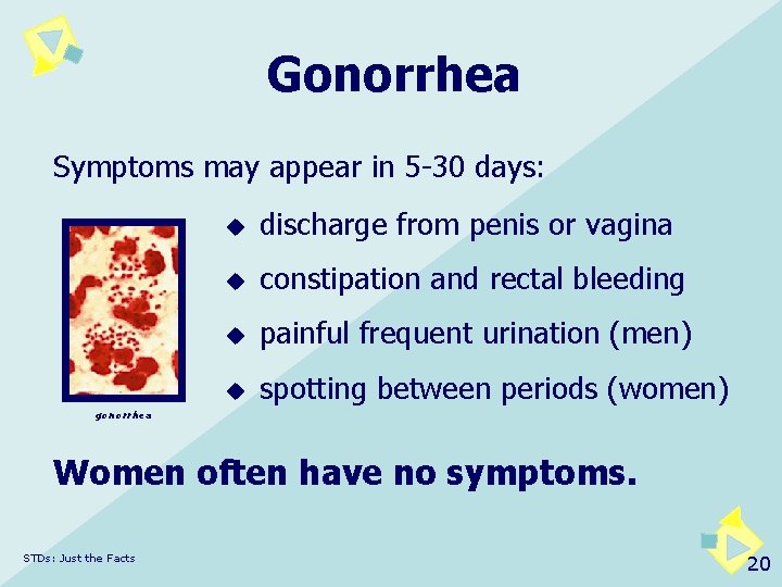 Gonorrhea Symptoms may appear in 5 -30 days: u discharge from penis or vagina