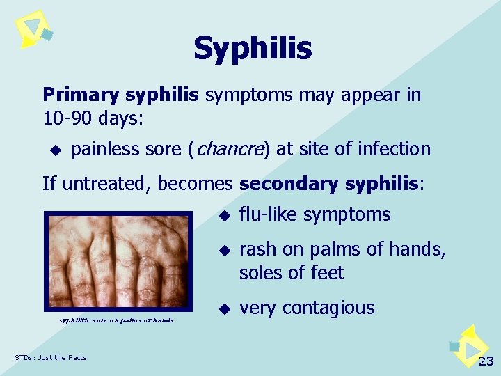 Syphilis Primary syphilis symptoms may appear in 10 -90 days: u painless sore (chancre)