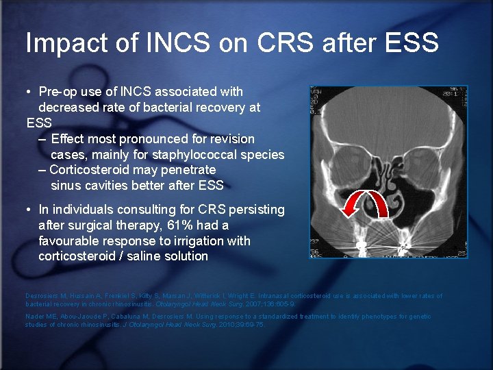 Impact of INCS on CRS after ESS • Pre-op use of INCS associated with