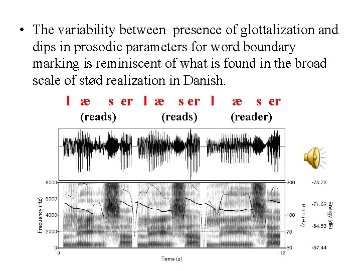  • The variability between presence of glottalization and dips in prosodic parameters for