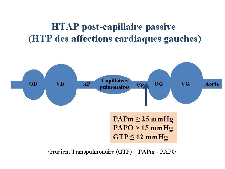 HTAP post-capillaire passive (HTP des affections cardiaques gauches) OD VD AP Capillaires pulmonaires VP HTAP post-capillaire passive (HTP des affections cardiaques gauches) OD VD AP Capillaires pulmonaires VP