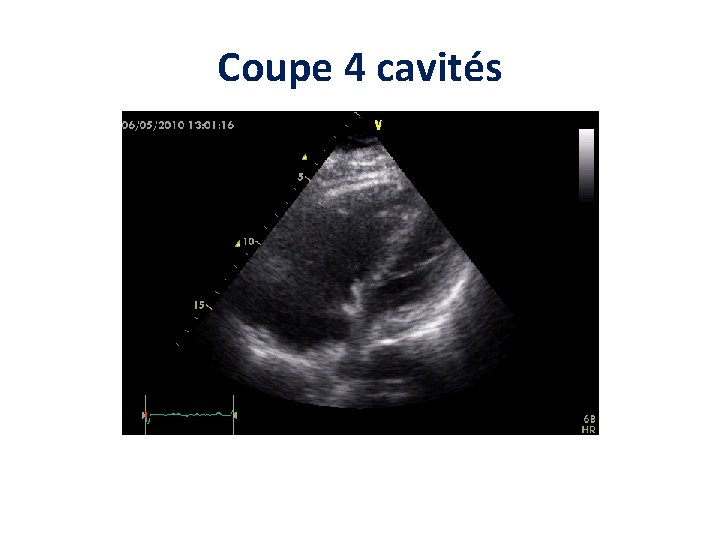Coupe 4 cavités Coupe 4 cavités