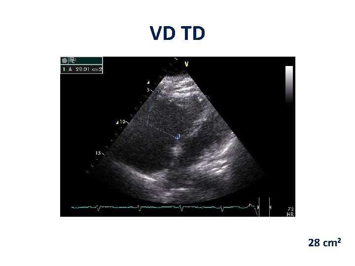 VD TD 28 cm 2 VD TD 28 cm 2