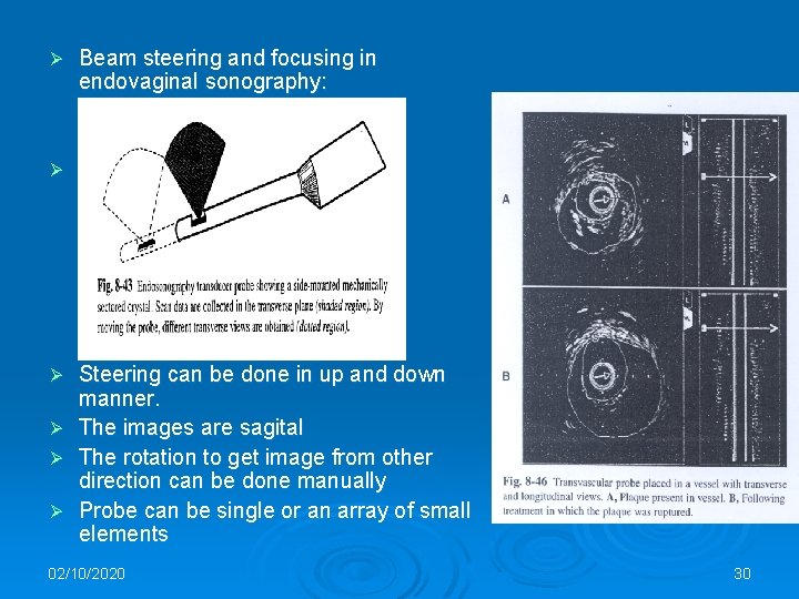 Ø Beam steering and focusing in endovaginal sonography: Ø Steering can be done in