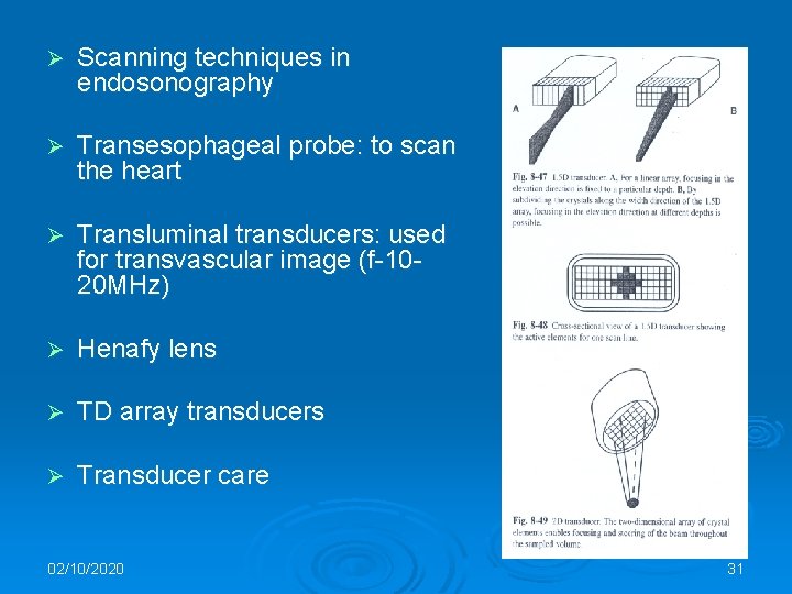 Ø Scanning techniques in endosonography Ø Transesophageal probe: to scan the heart Ø Transluminal