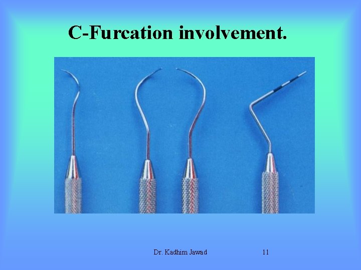 C-Furcation involvement. Dr. Kadhim Jawad 11 