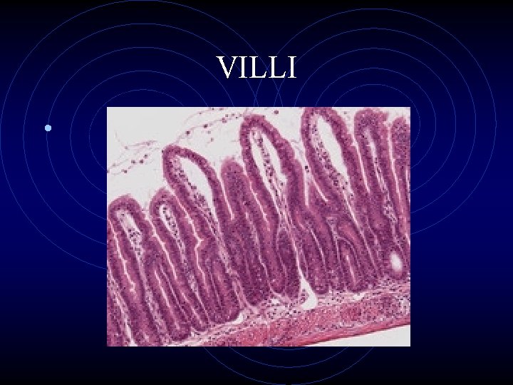 VILLI • 