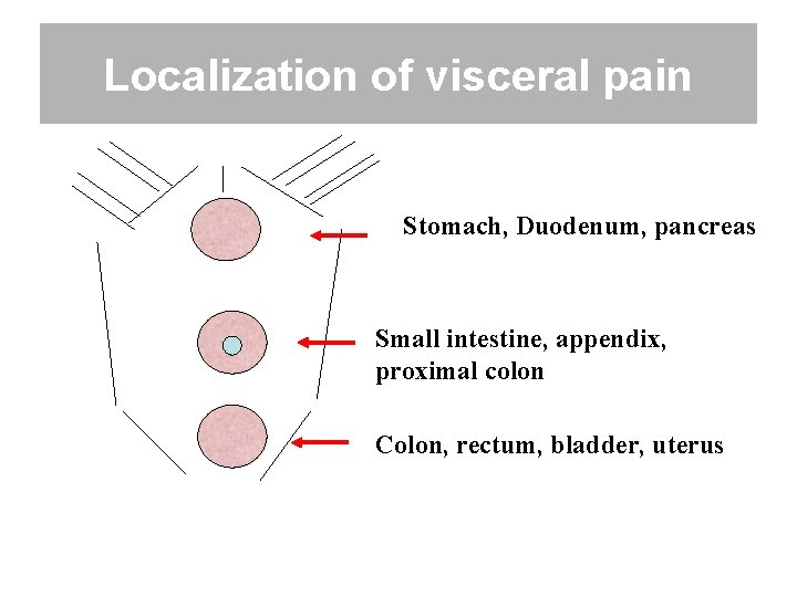 Localization of visceral pain Stomach, Duodenum, pancreas Small intestine, appendix, proximal colon Colon, rectum,