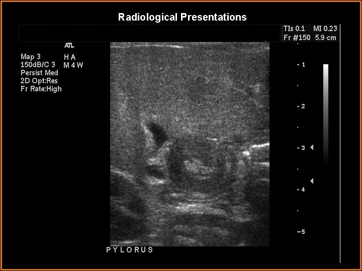 Radiological Presentations 2 DAYS LATER 