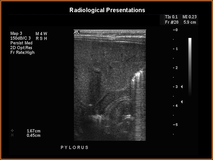 Radiological Presentations 