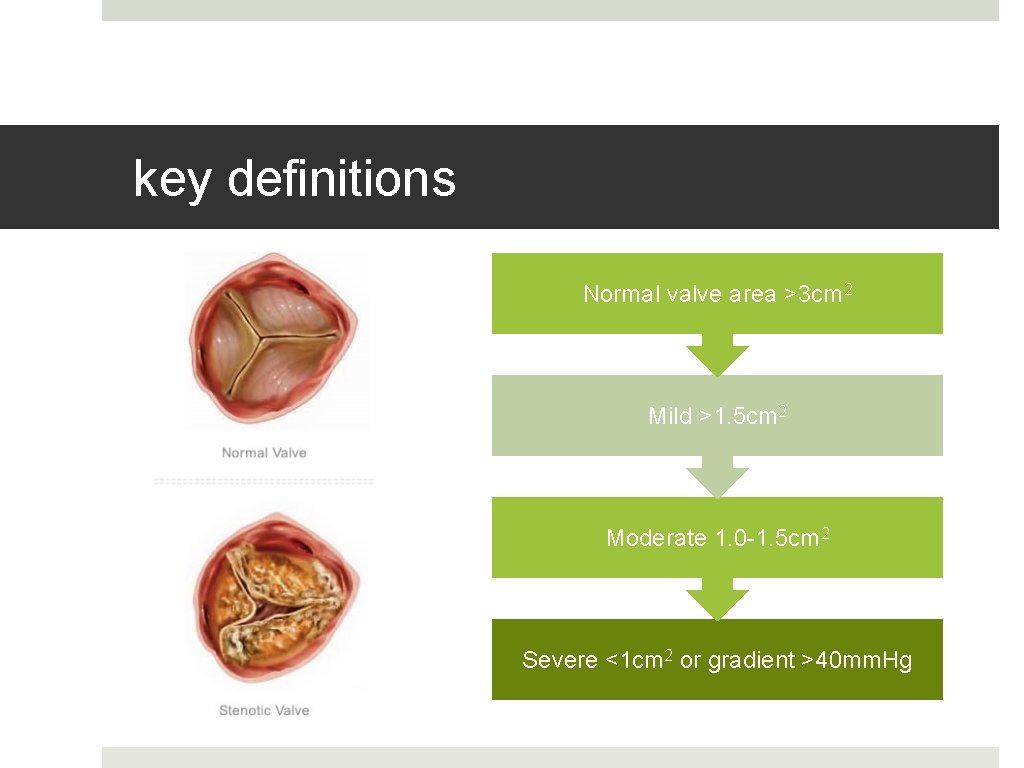 key definitions Normal valve area >3 cm 2 Mild >1. 5 cm 2 Moderate