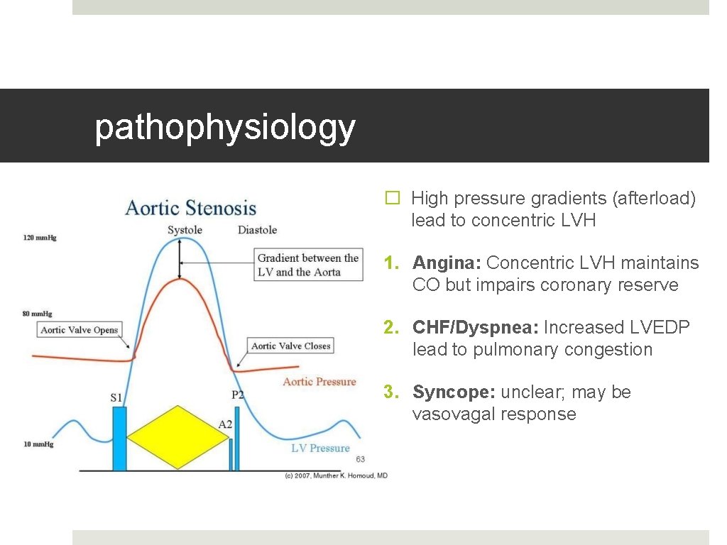 pathophysiology � High pressure gradients (afterload) lead to concentric LVH 1. Angina: Concentric LVH