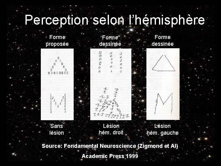 Perception selon l’hémisphère Forme proposée Forme dessinée Sans lésion Lésion hém. droit Lésion hém.