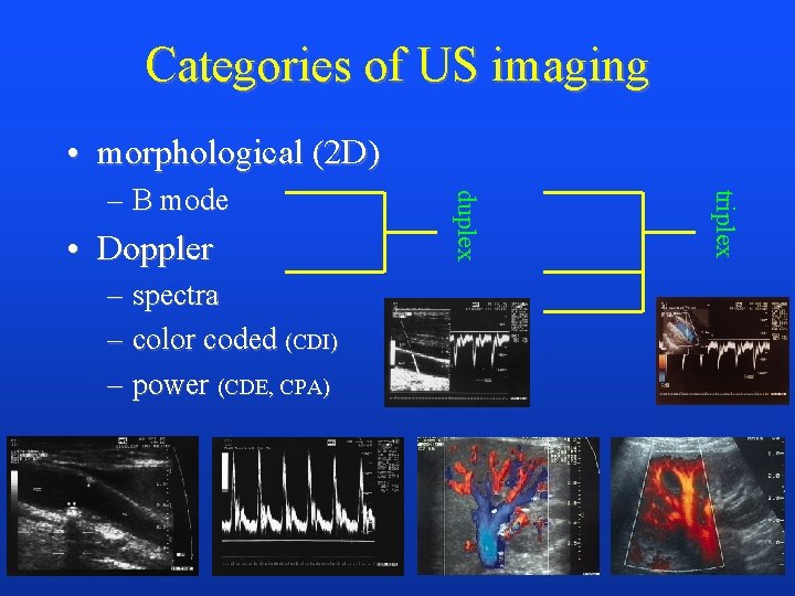 Categories of US imaging • morphological (2 D) – spectra – color coded (CDI)