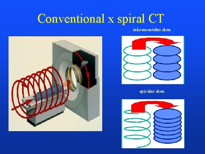 Conventional x spiral CT inkrementální sken spirální sken 