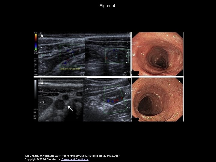 Figure 4 The Journal of Pediatrics 2014 16578 -84. e 2 DOI: (10. 1016/j.