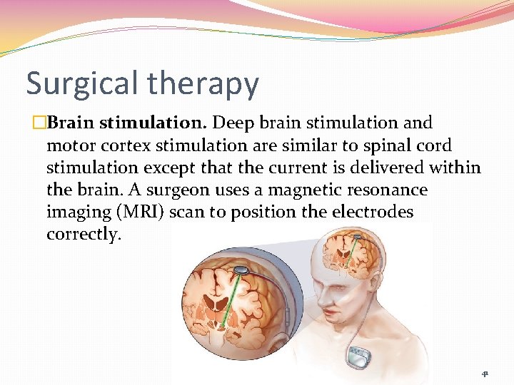 Surgical therapy �Brain stimulation. Deep brain stimulation and motor cortex stimulation are similar to