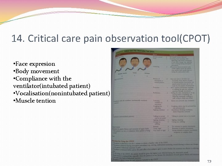 14. Critical care pain observation tool(CPOT) • Face expresion • Body movement • Compliance