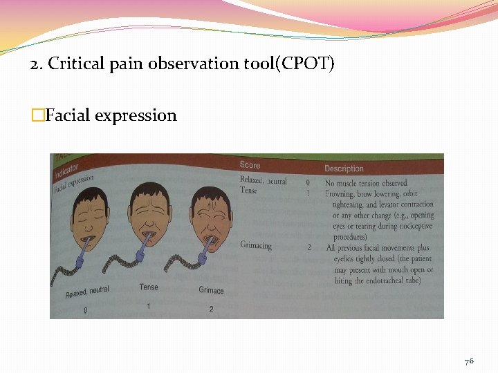 2. Critical pain observation tool(CPOT) �Facial expression 76 